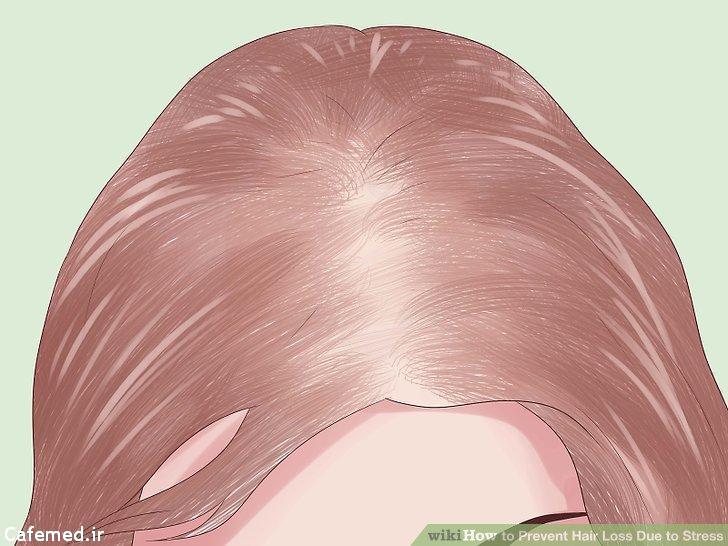 ماسک طبیعی برای مقابله با ریزش مو