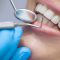 ایمپلنت دندان کره ‌ای؛ اقساطی و فوری در دندانپزشکی آرامش