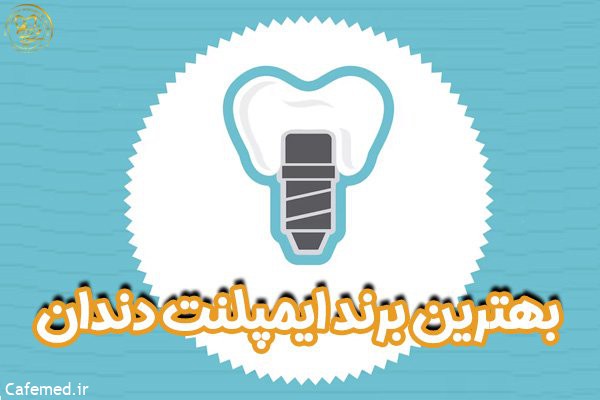 ایمپلنت دندان - دکتر امیر محمدی