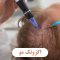 اگزوتک مو ؛ روش نوین درمان ریزش مو در کلینیک‌های تخصصی زیبایی