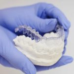 ارتودنسی نامرئی بدون سیم کشی